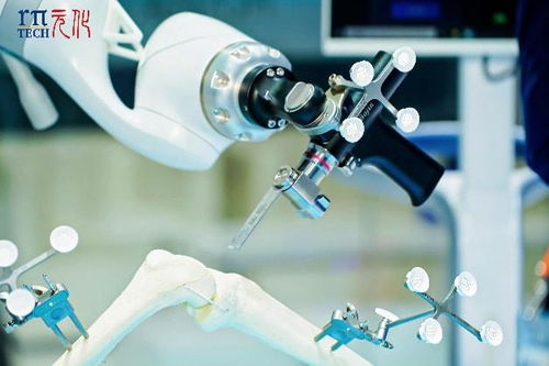 科技賦能醫(yī)療新未來 元化智能錕铻全骨科手術(shù)機(jī)器人閃耀進(jìn)博會